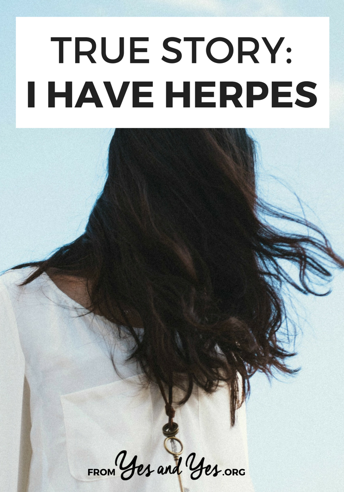 Herpes and pregnancy stories