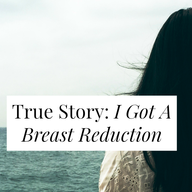 True Story: I Got A Breast Reduction 