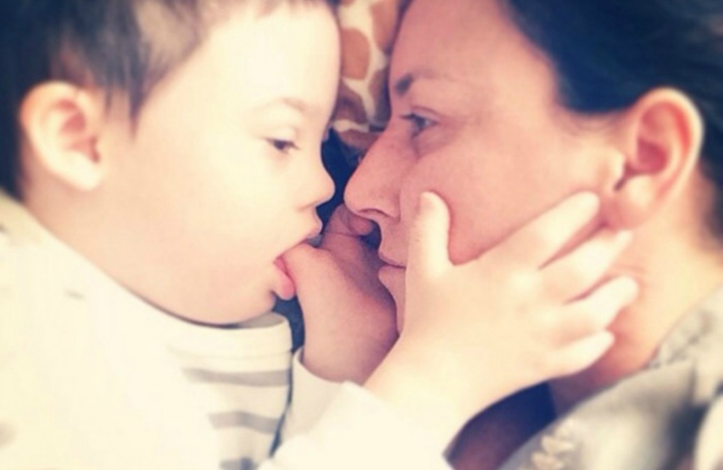 True Story: My Son Has Down Syndrome